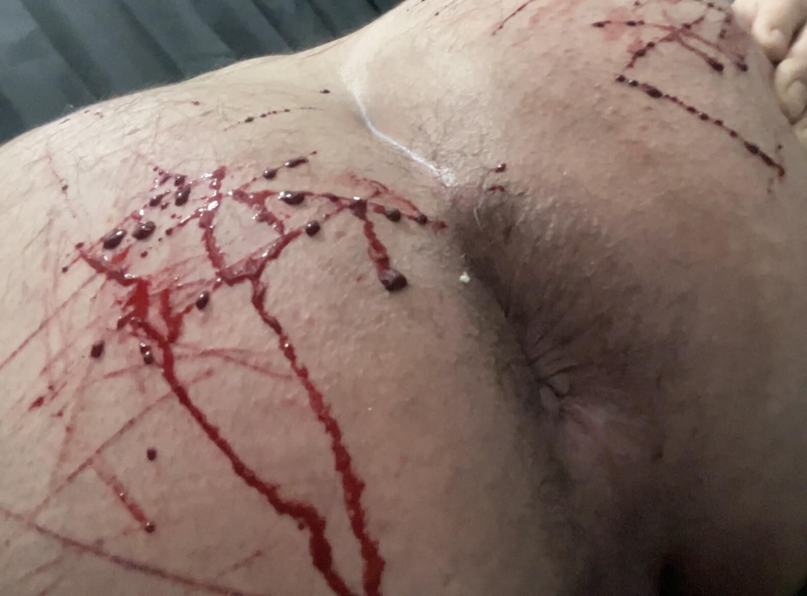 Auto -tortura, sangue real