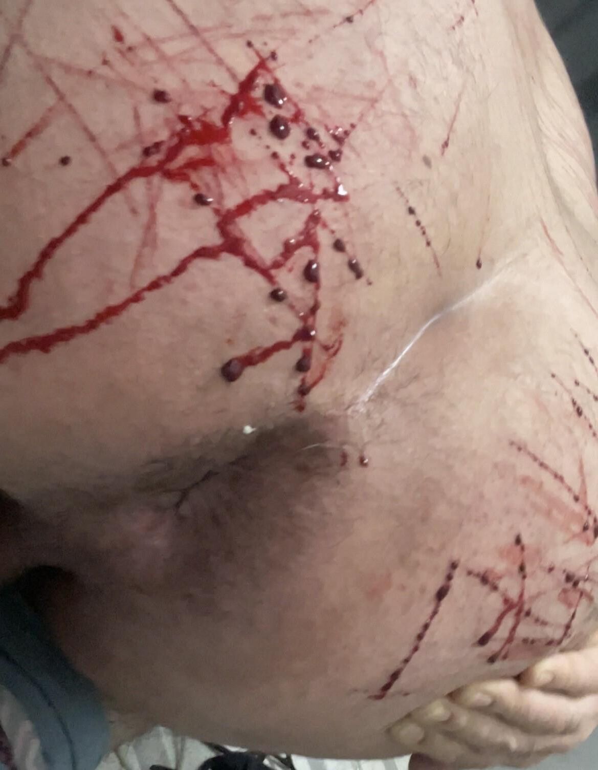 Auto -tortura, sangue real