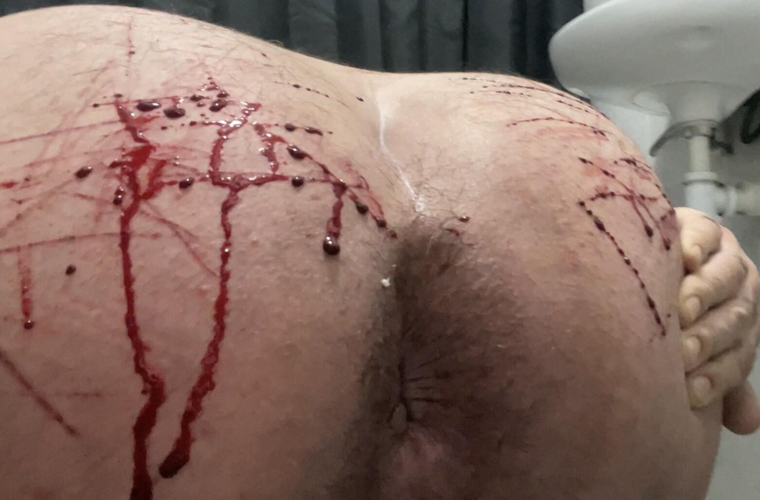 Auto -tortura, sangue real
