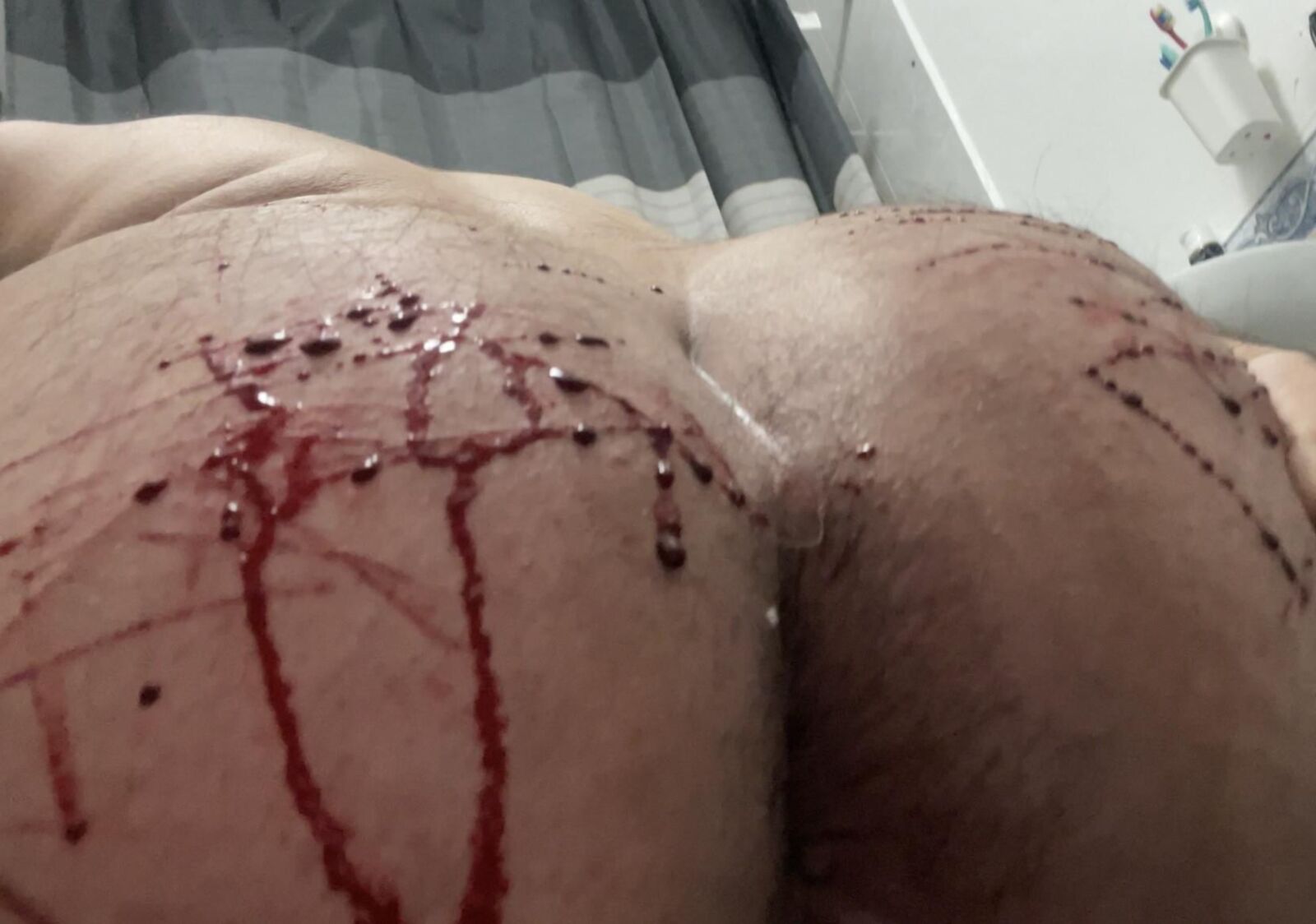 Auto -tortura, sangue real