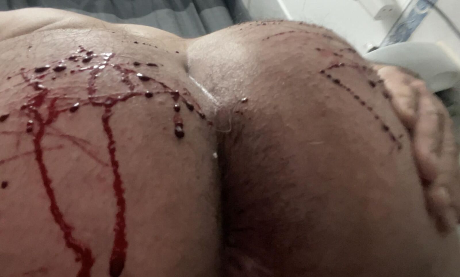 Auto -tortura, sangue real