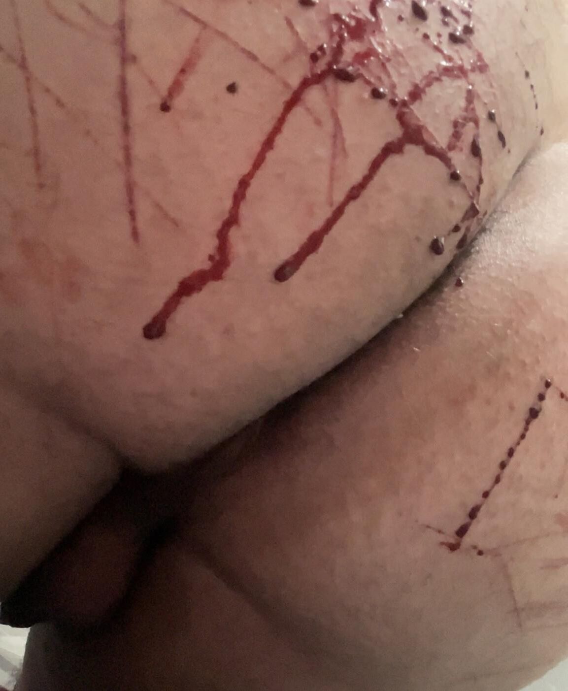 Auto -tortura, sangue real