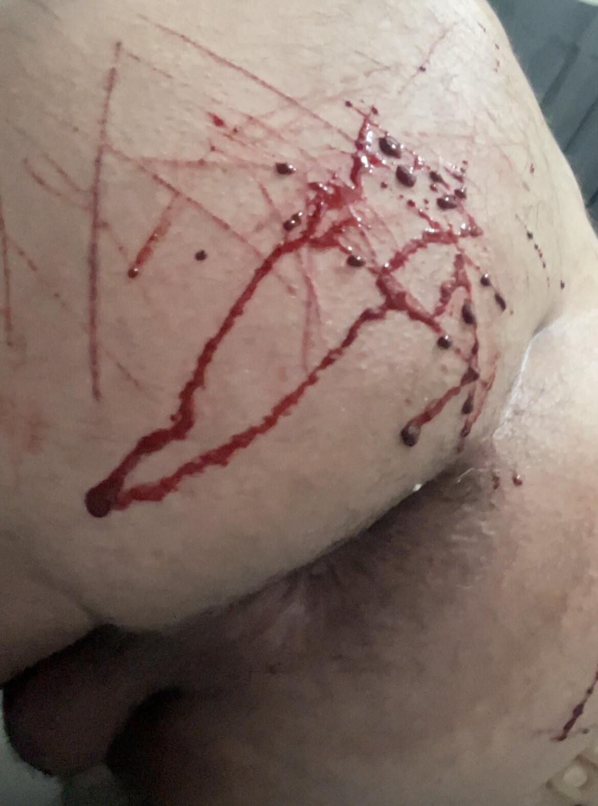 Auto -tortura, sangue real