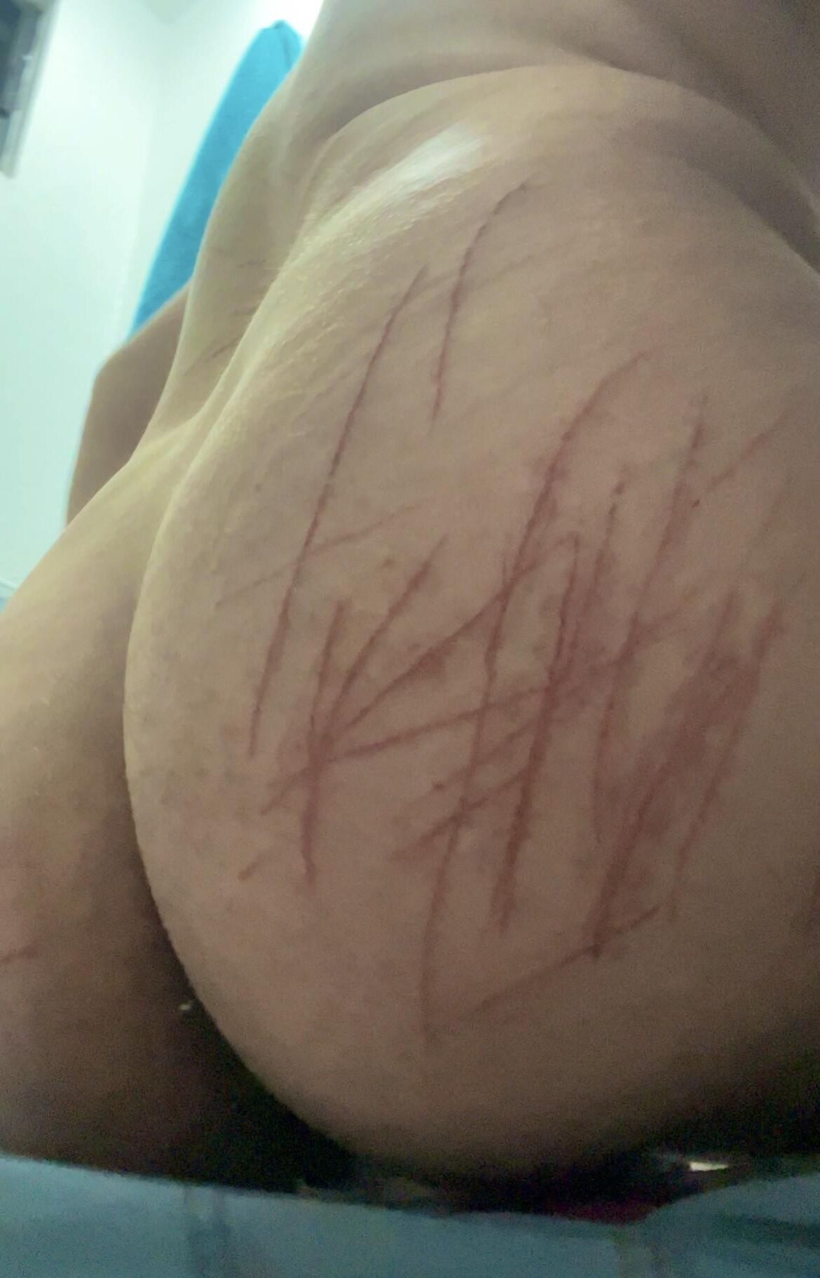 Auto -tortura, sangue real