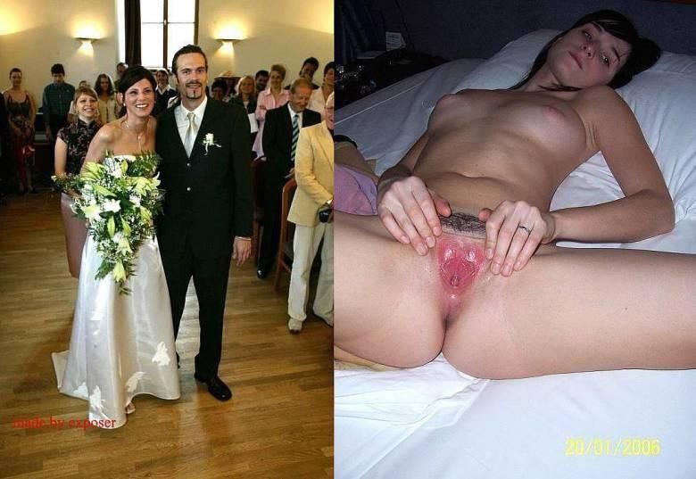 Before and After OMG 