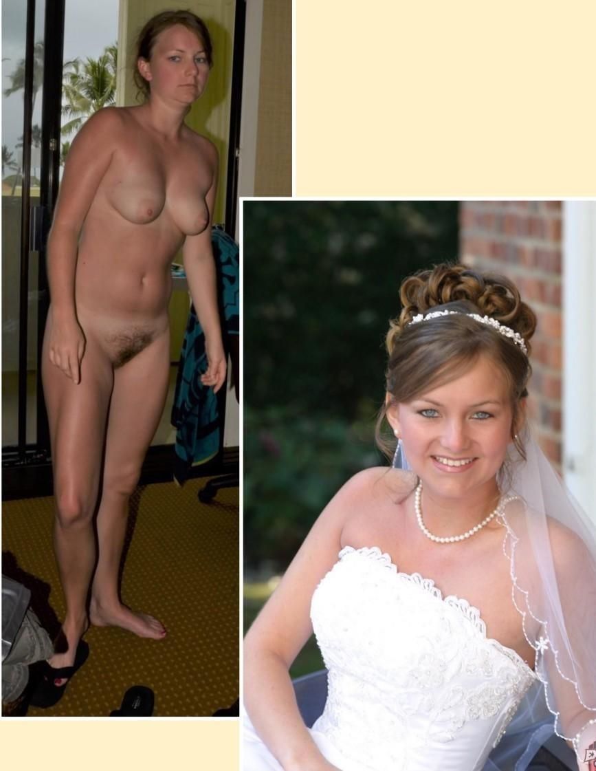 Before and After OMG 