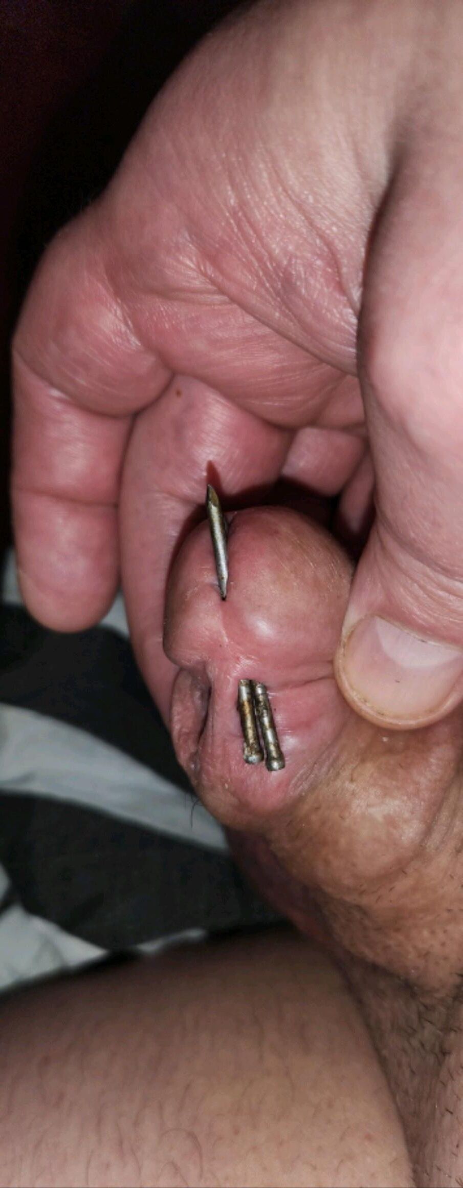 危険な残忍なCBT