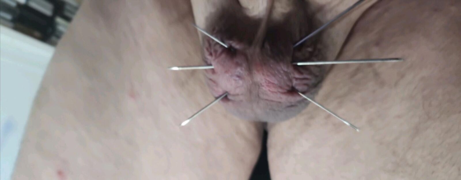 危険な残忍なCBT