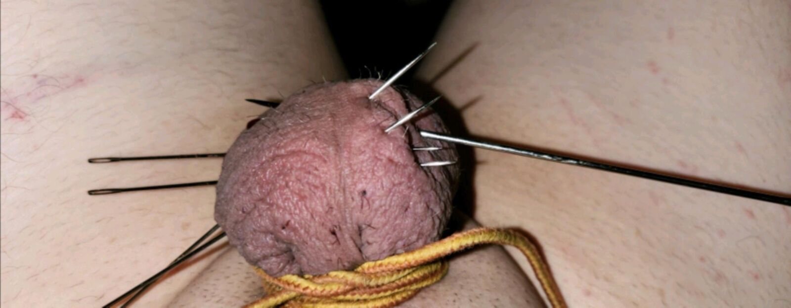 危険な残忍なCBT