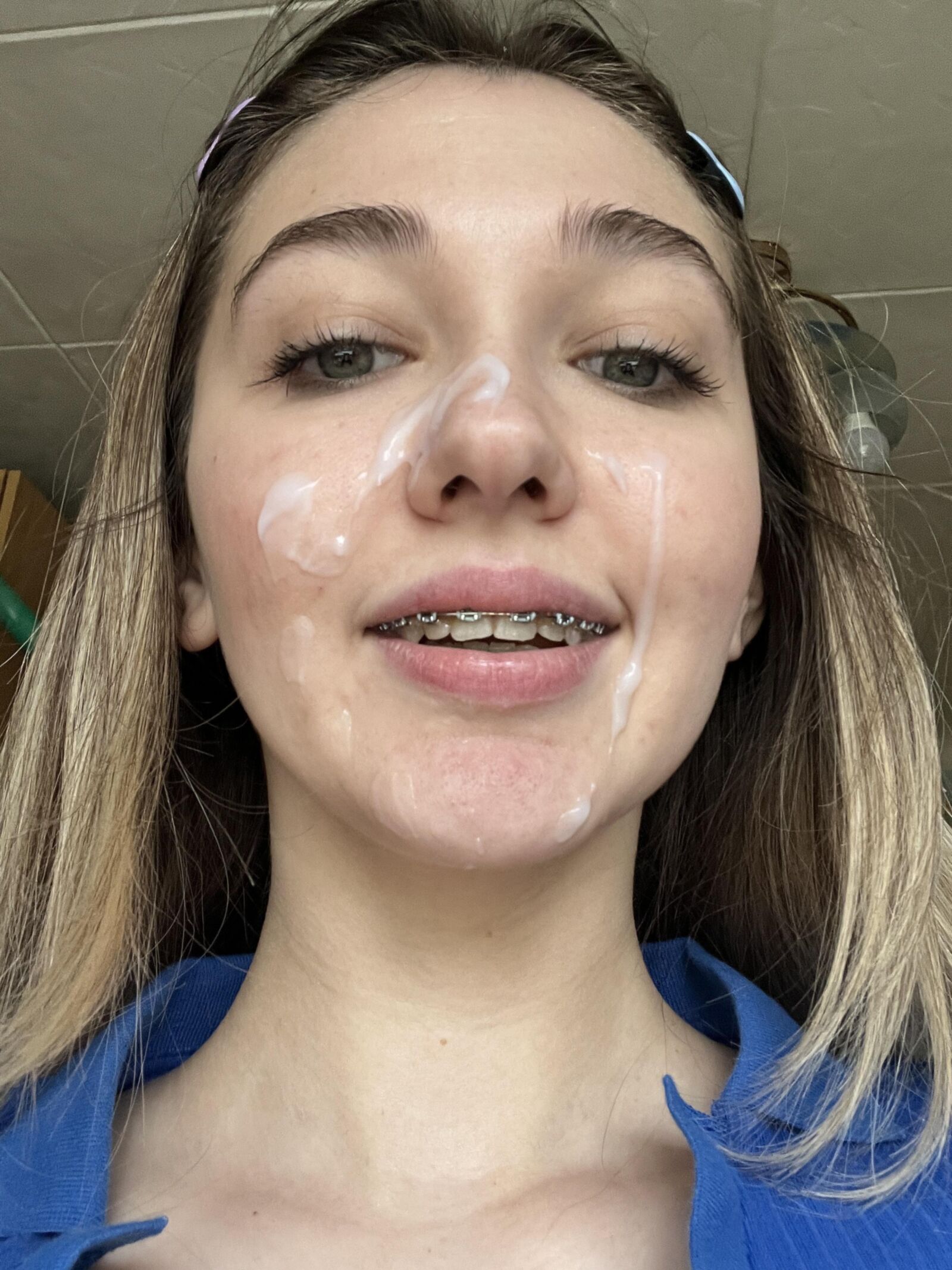 Zahnspange